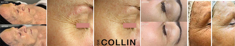Collagen 90+ before-after-tulemused-slaider.jpg (145 KB)